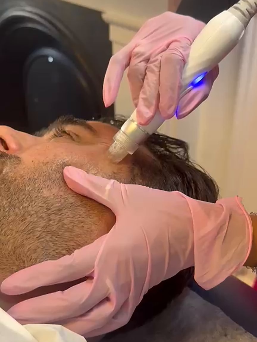 Hydra Facial