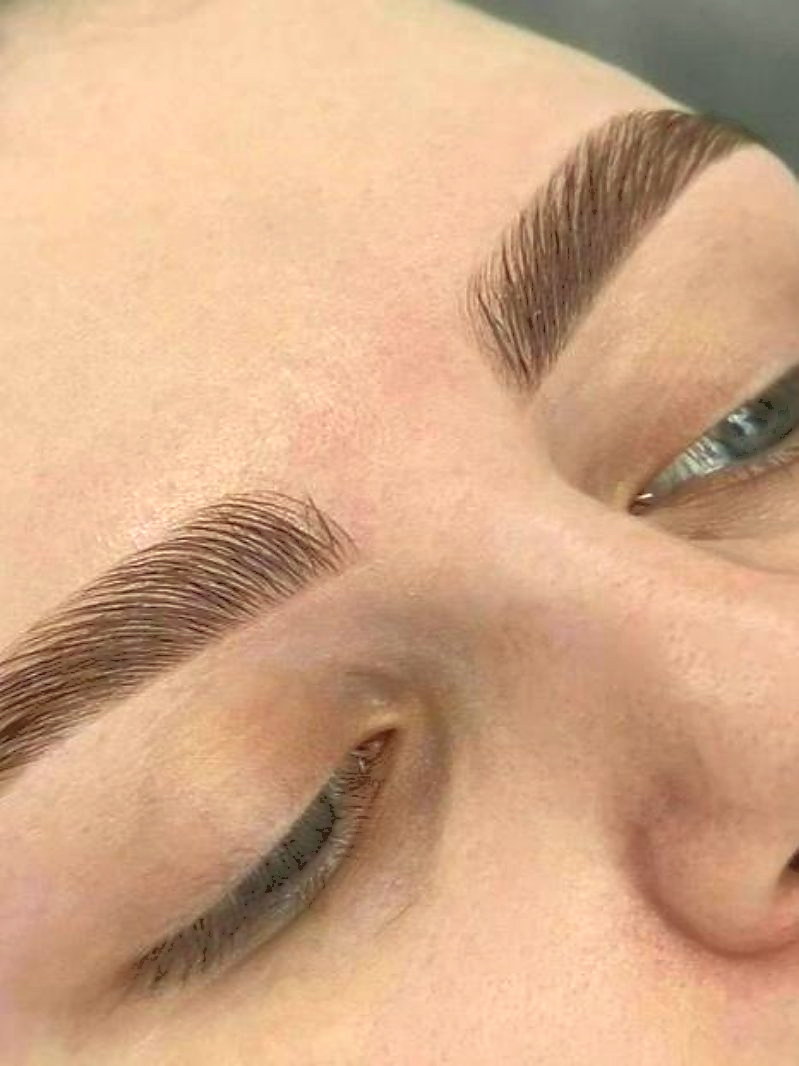 Healed brow shape