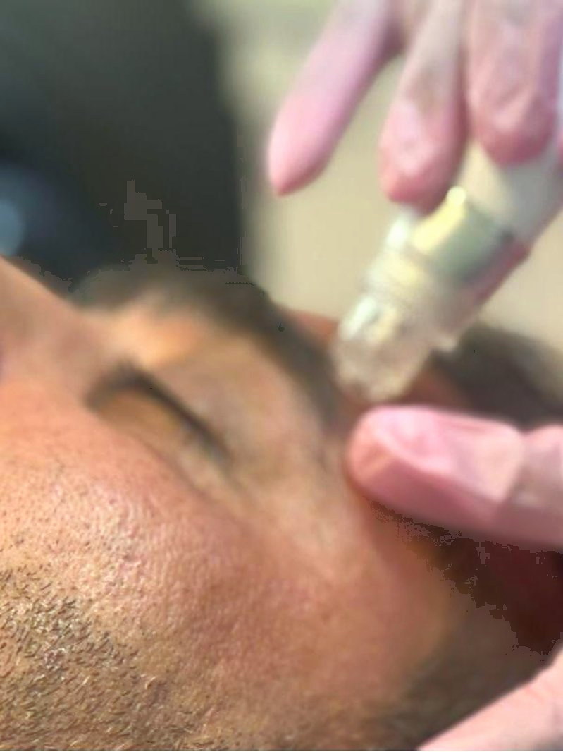 Client receiving a facial with gloved hands in frame