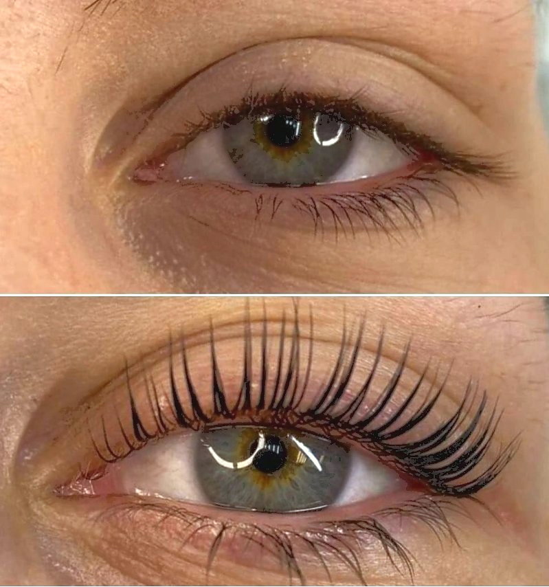 Lash extensions around the eye